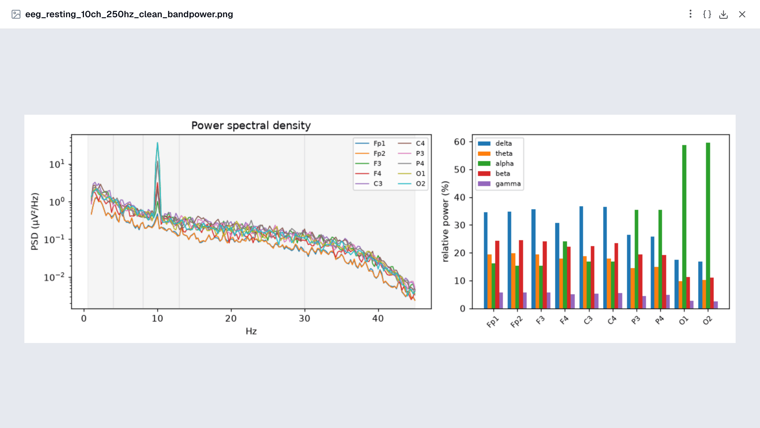 Band power: the PSD of every channel with the 10 Hz alpha peak, and relative power per band. Alpha dominates at O1 and O2.