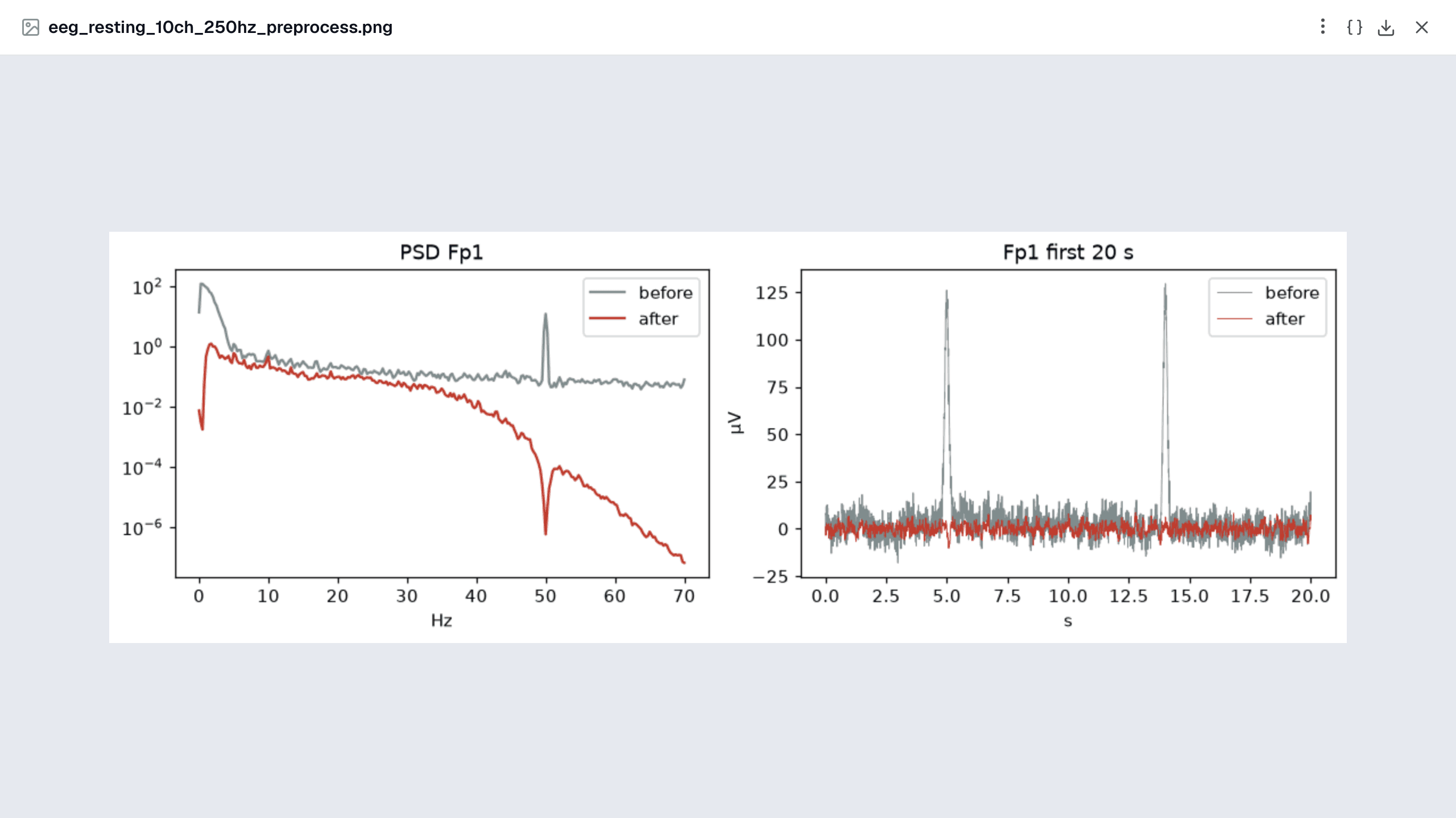 Preprocessing before and after on Fp1: the 50 Hz peak disappears from the spectrum and the blinks disappear from the trace.
