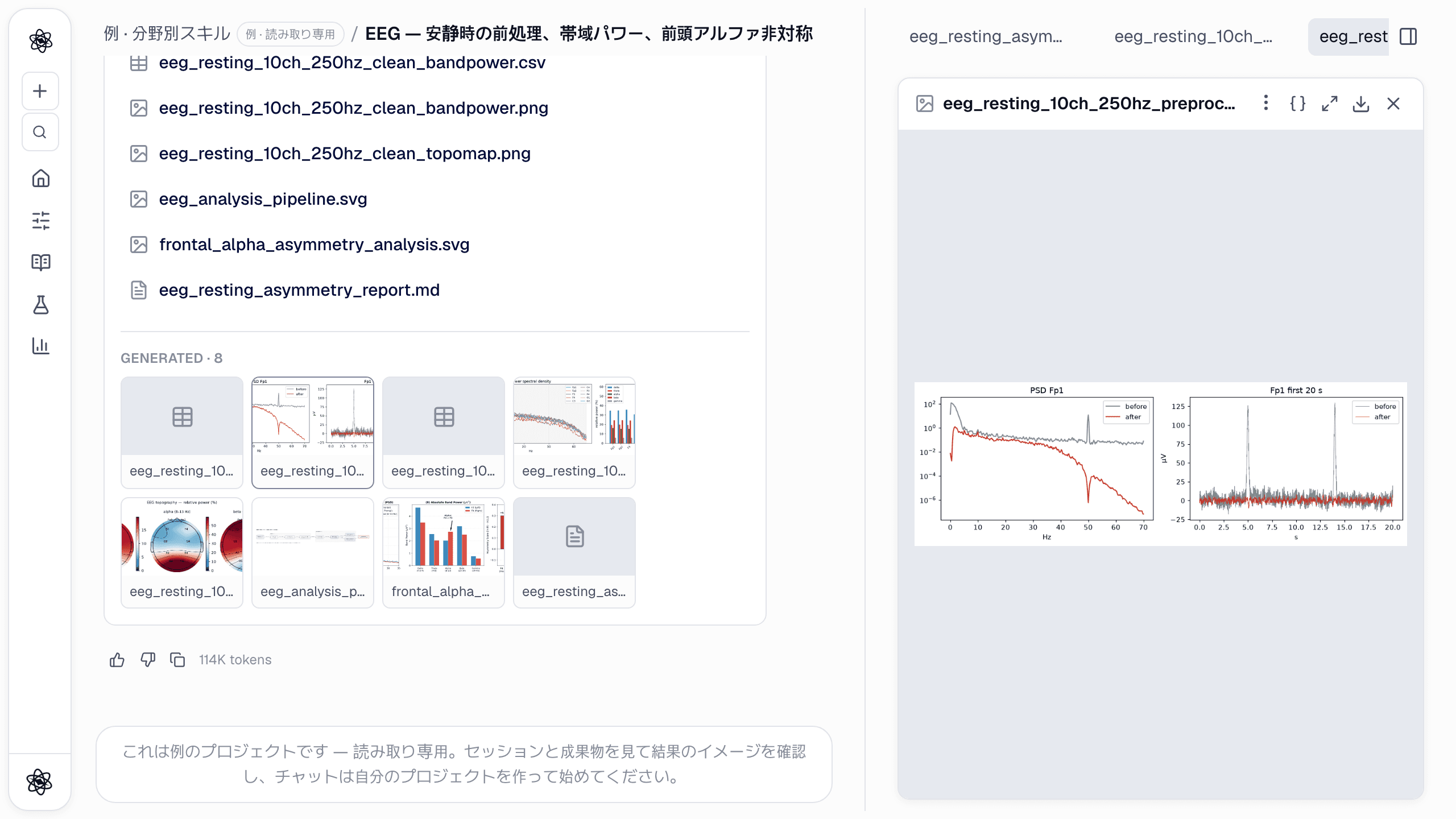 前処理の前後：スペクトルから 50 Hz の電源ノイズのピークが消え、Fp1 の前頭部の瞬目が除去されています。
