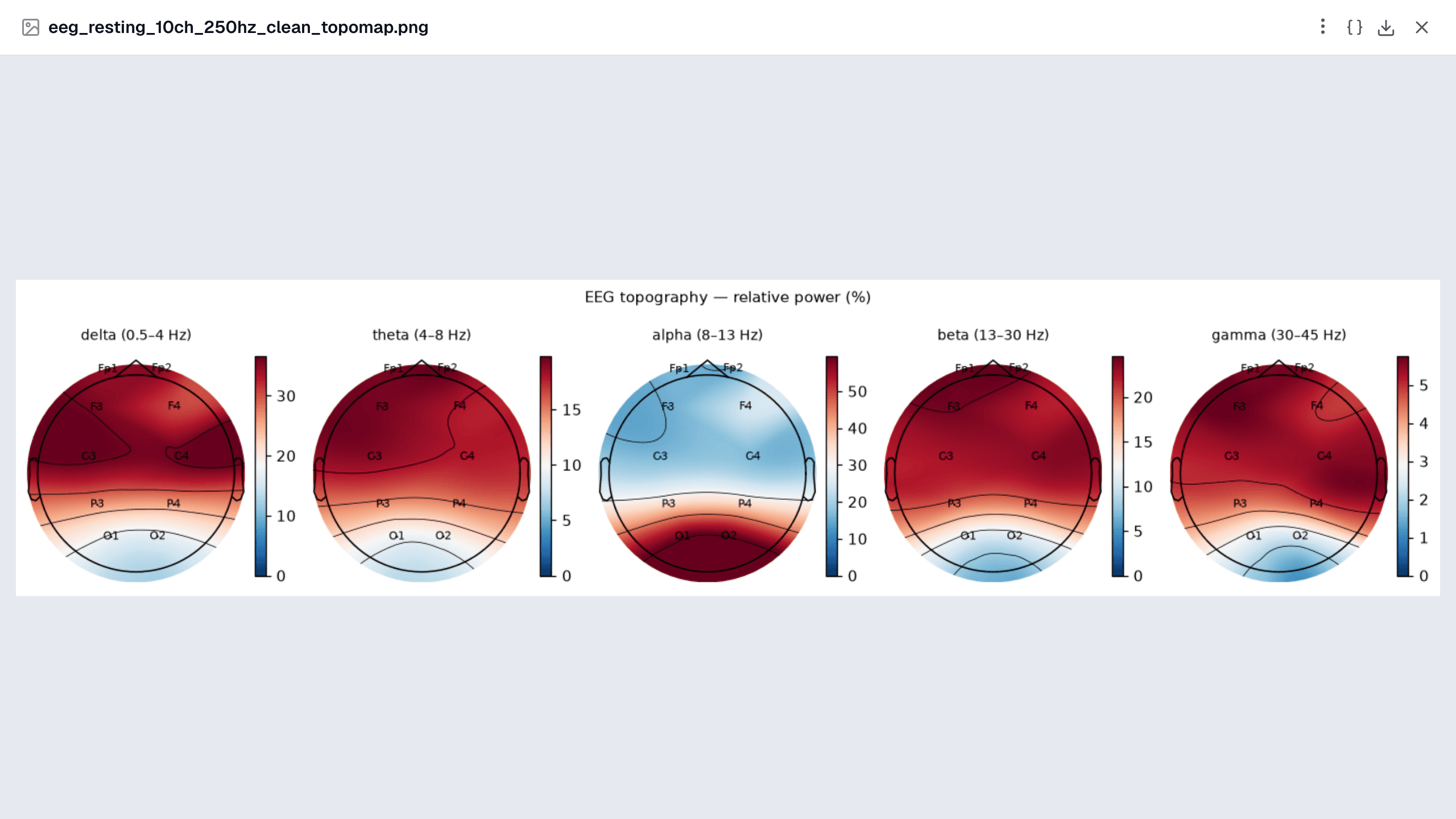 Relative band power over the scalp. Alpha concentrates over O1/O2 in an eyes-closed recording.